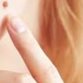 Onion Juice Remedy: A Natural Way to Remove Moles at Home