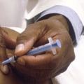 Risks of the Excisional Biopsy Technique