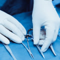 Everything You Need to Know About the Extent of the Procedure