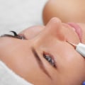 Location and Size of Moles: Everything You Need to Know