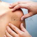 Scheduling the Procedure for Mole Removal Surgery