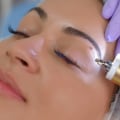 Chemical treatments for Mole Removal Procedures