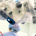 Excisional Surgery: A Comprehensive Overview