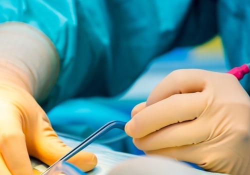 Understanding Electrosurgery: A Comprehensive Overview