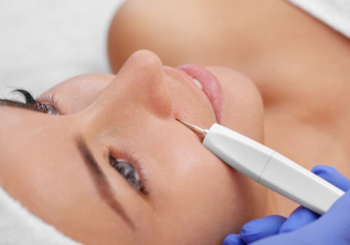 Location and Size of Moles: Everything You Need to Know