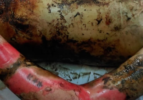 Burning with Acids: A Comprehensive Overview