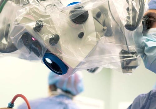 Excisional Surgery: A Comprehensive Overview